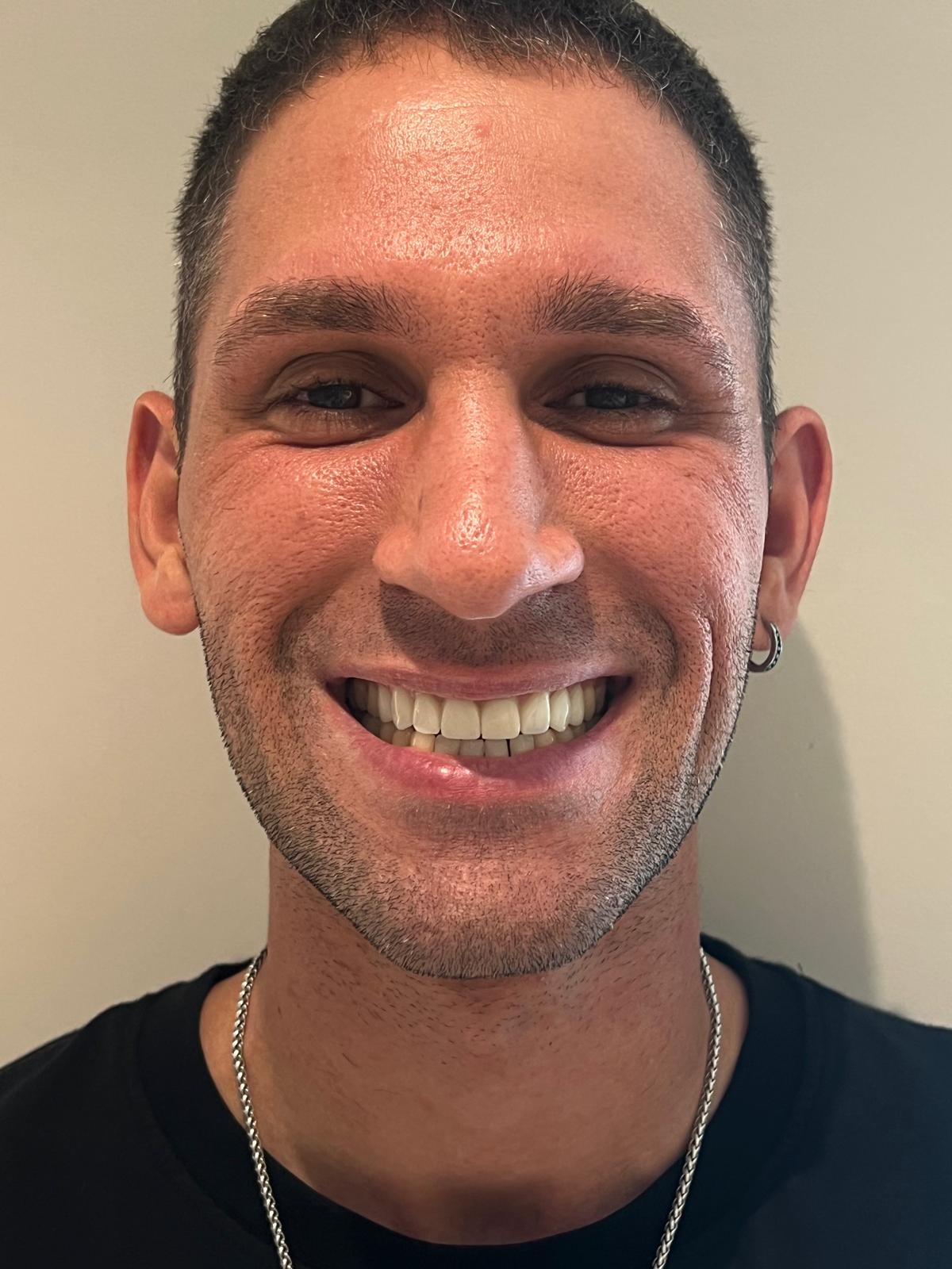 ECE Dental Patient Transformation